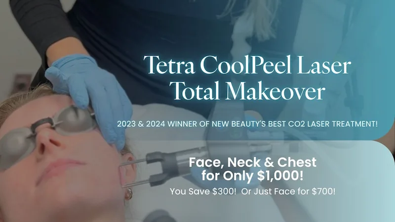Woman holding Juvederm skincare products with discounts.